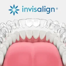 Why Choose Jersey Smile for Your Invisalign Treatment in Berkeley Heights?