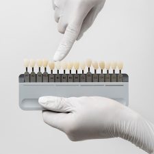 Eating & Lifestyle Tips With Veneers: What to Eat and What to Avoid